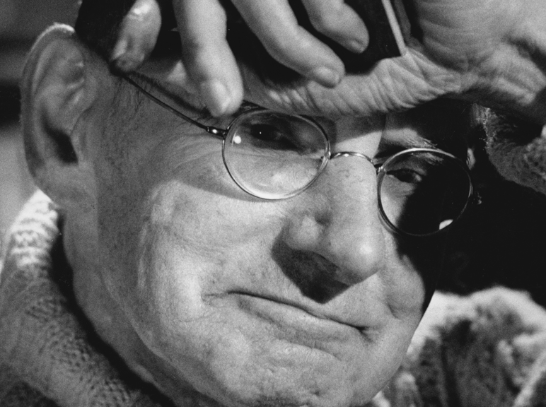 sean_hand_brow-772x576